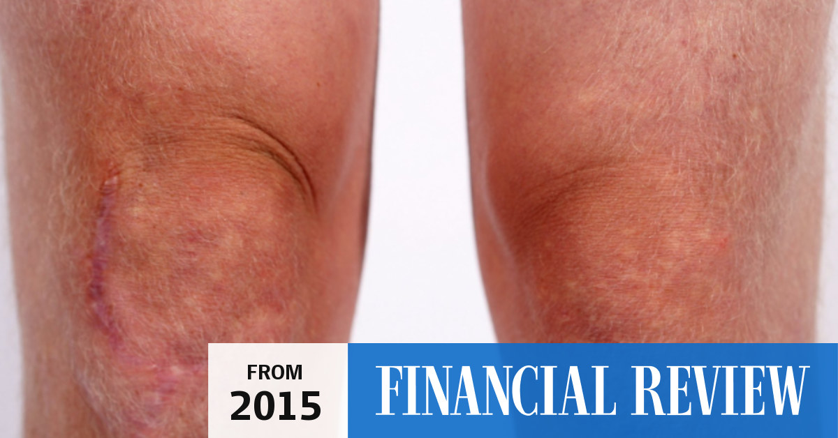 Is arthroscopy a dicky procedure for a dicky knee?